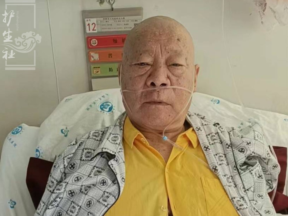 72岁桑宝师父，罹患慢性肺源性心脏病