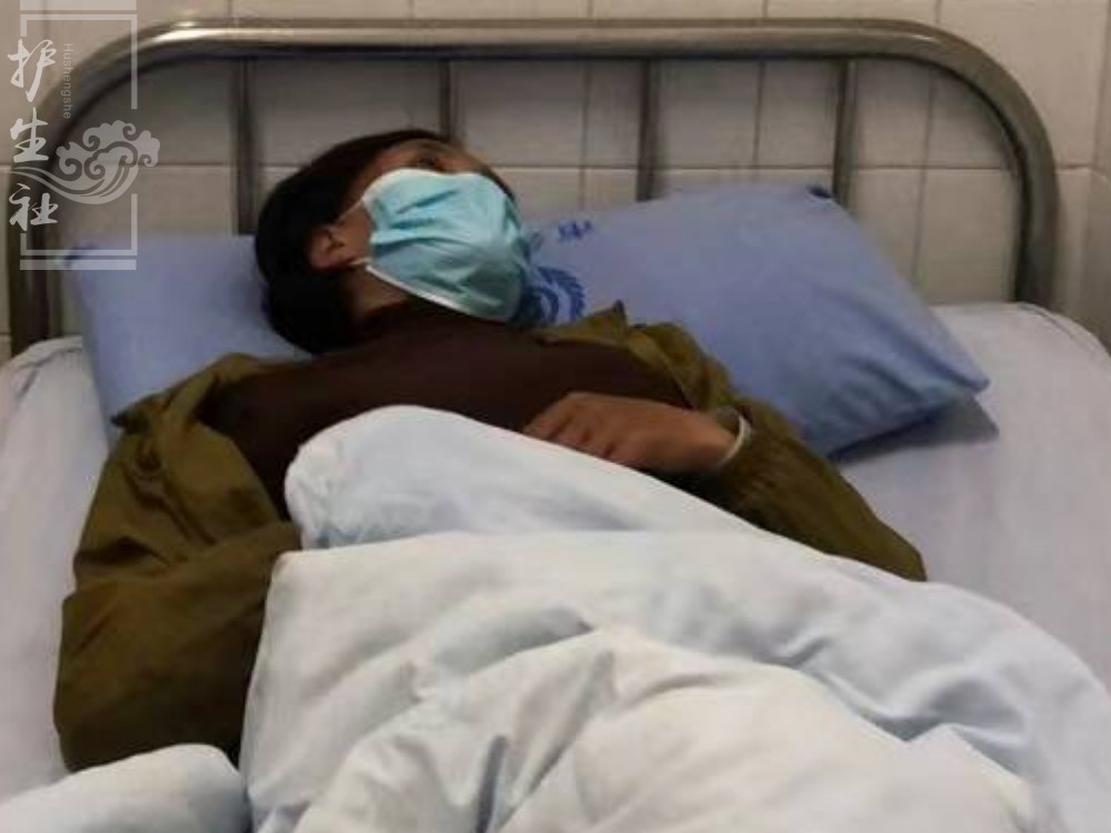 亚玛患肺结核3年，需继续抗结核治疗